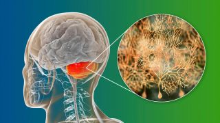 Human brain with highlighted cerebellum and close-up view of cerebellar Purkinje cells.