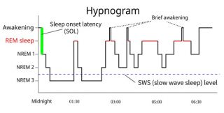 NREM sleep deepens as we fall asleep, with the EEG showing a characteristic slow wave, high amplitude pattern. REM sleep (indicated in red) is characterized by an EEG that looks similar to the awake pattern (fast and small waves), even though we’re deeply asleep. REM sleep is characterized by what most people think of as dreams.