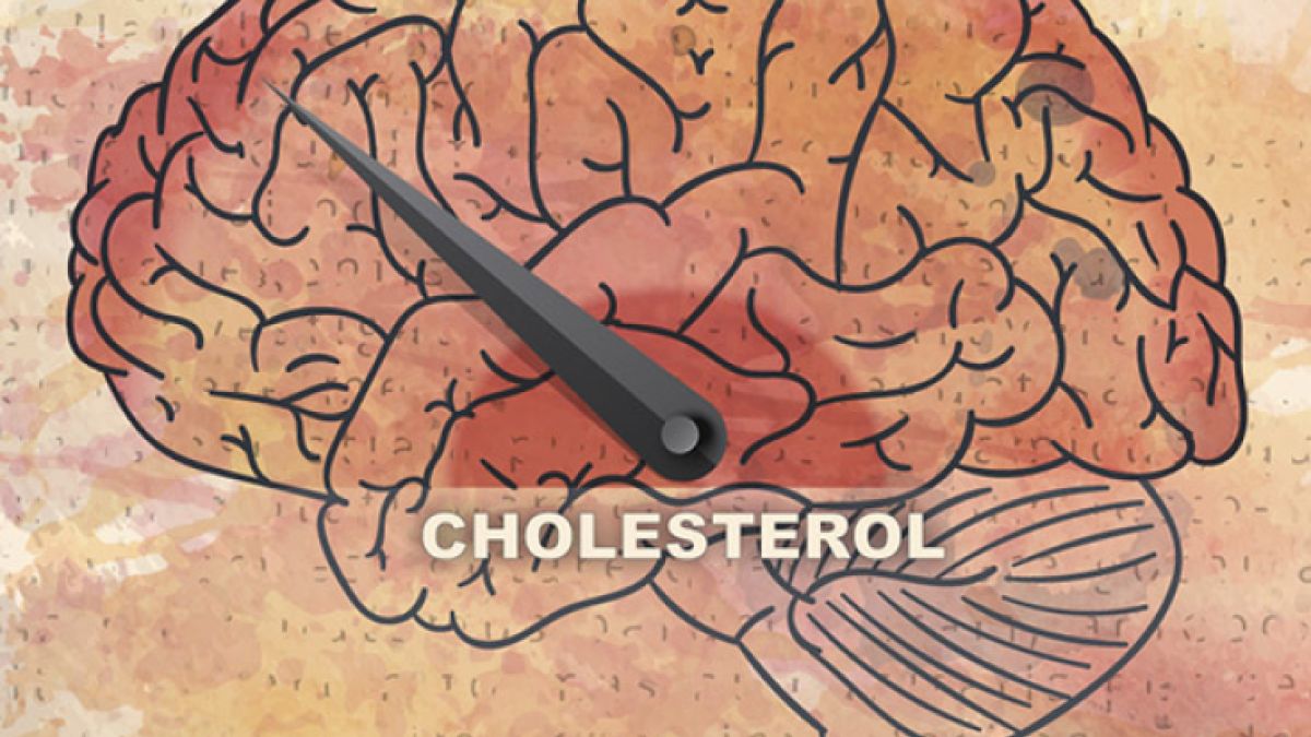 Low Brain Cholesterol: Separating Fact From Fiction