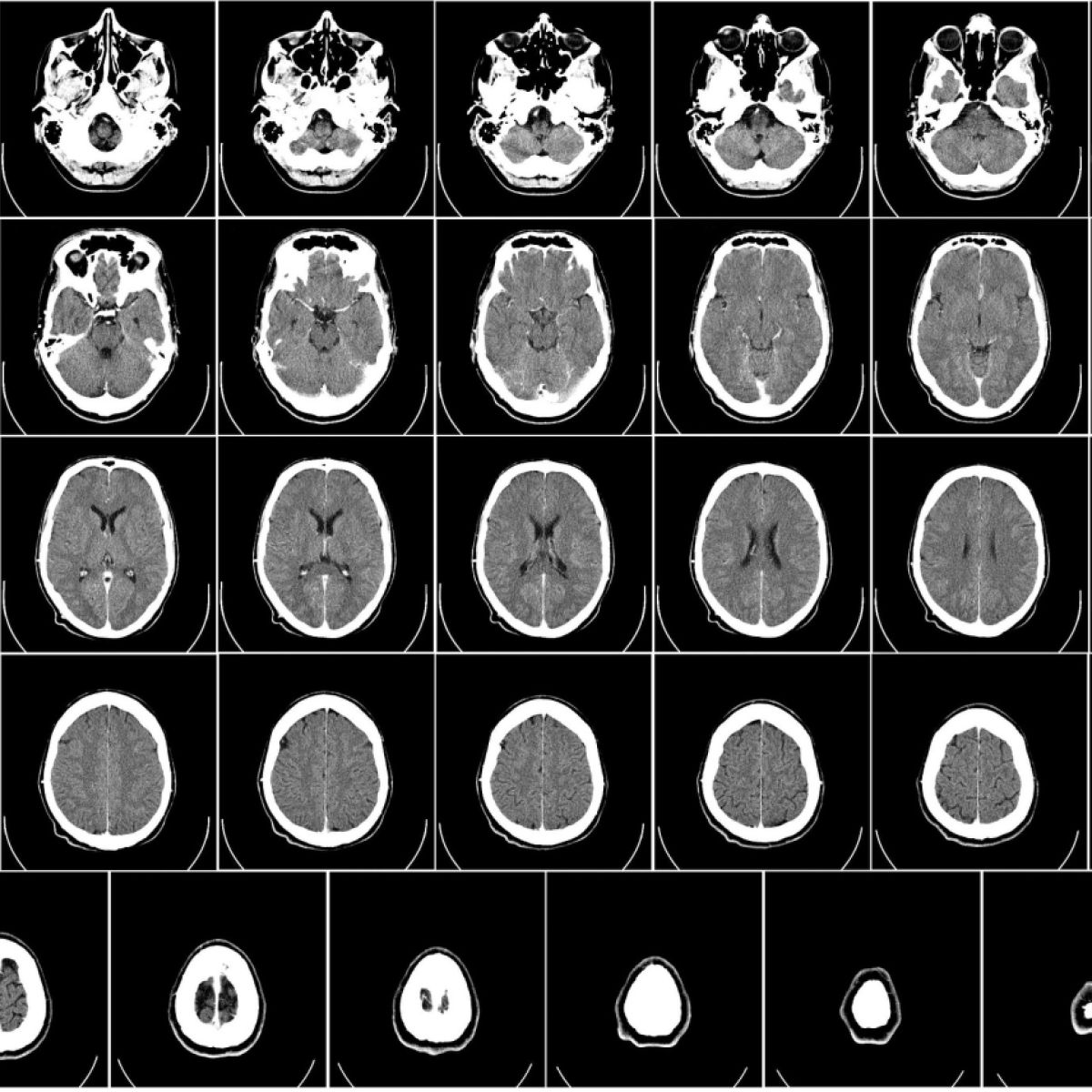 computer-tomography-62942_1920