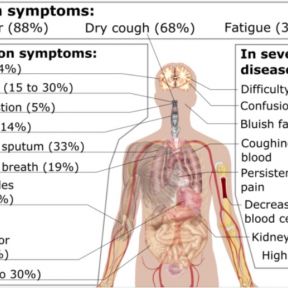 Symptoms of COVID-19