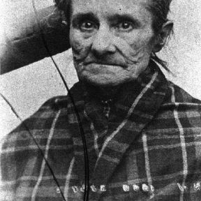 A woman with a diagnosis of chronic severe depression whose facial appearance suggests Parkinson's disease