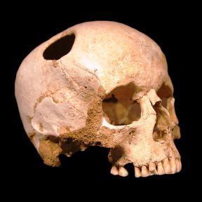 Skull of a Woman