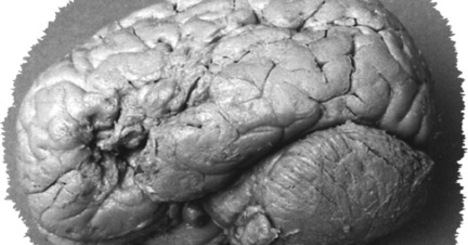 Today Was the Worst Day of Paul Broca's Life | Psychology Today, image size:1528x800