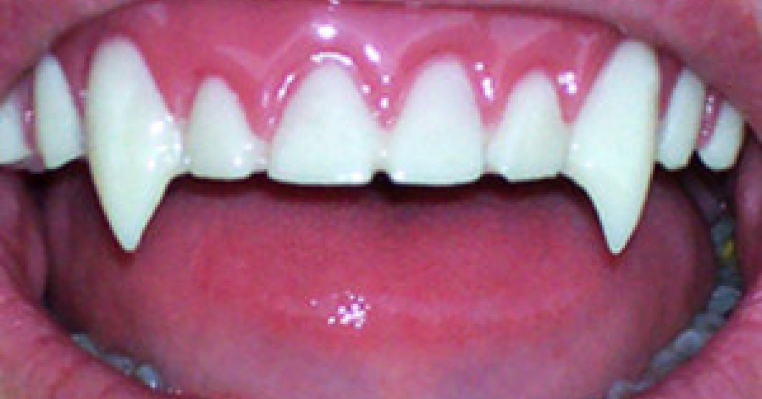 Verbal Abuse Psychology Today