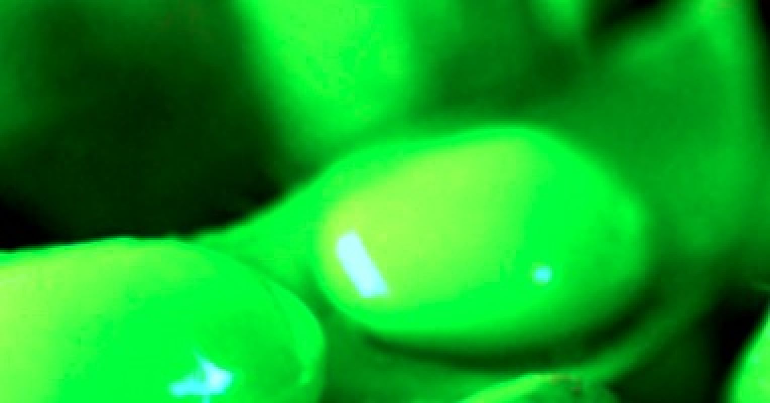 Soy Good or Bad? Psychology Today