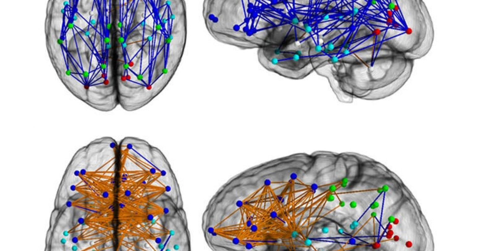 Brain Connectivity Varies Between Men and Women