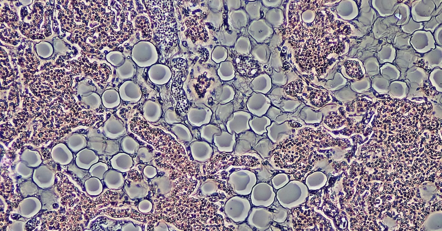 Could Glial Cells Be the Key to New Schizophrenia Treatments?