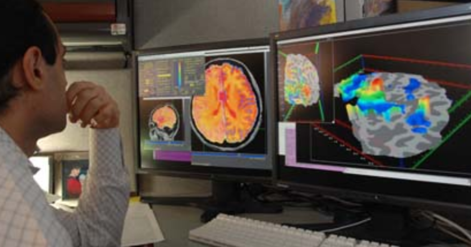 Two CerebellumRelated Tests Could Improve Autism Treatments