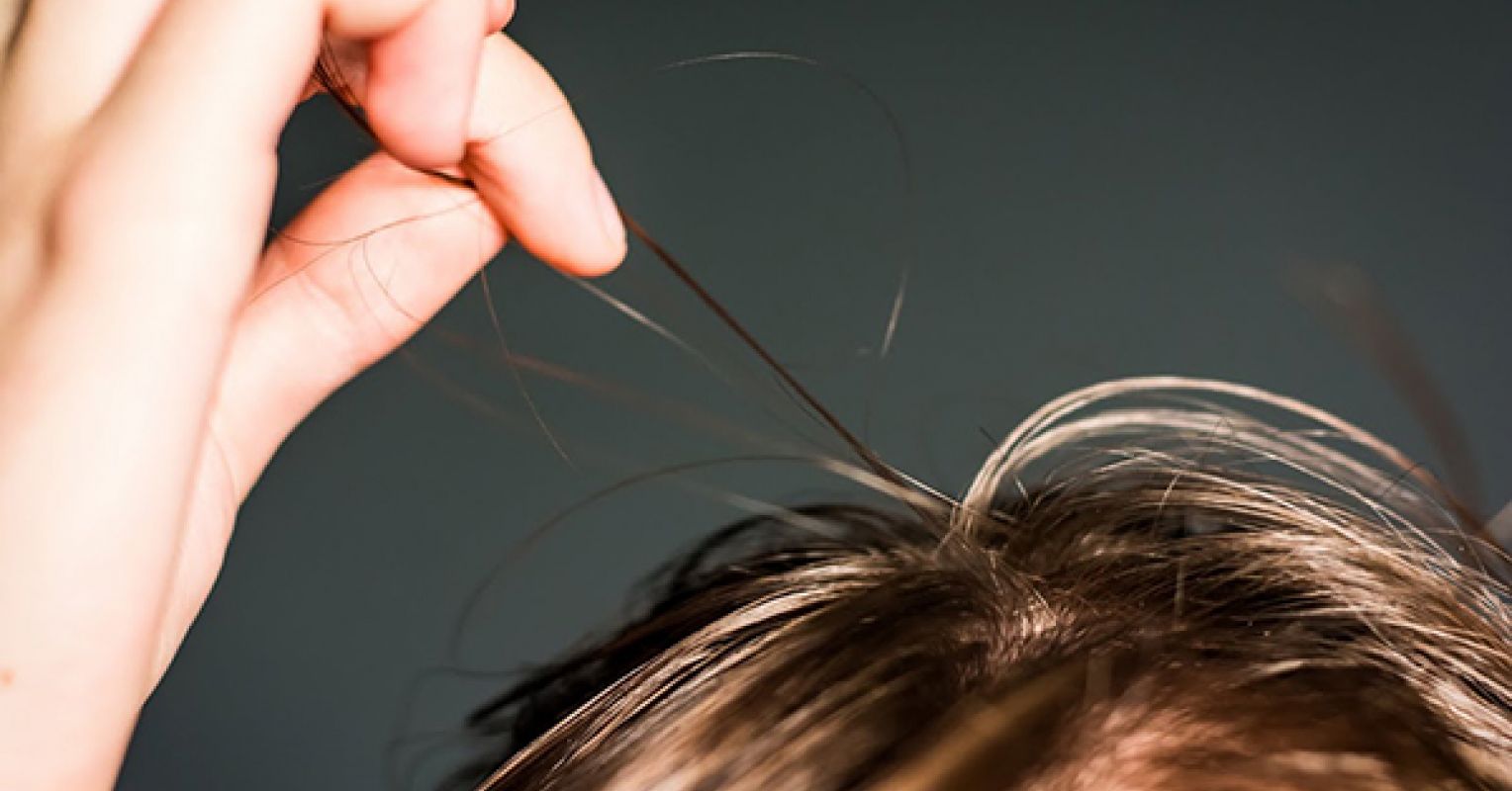 Tearing our hair out: learning to treat compulsive hair-pulling | Health |  The Guardian