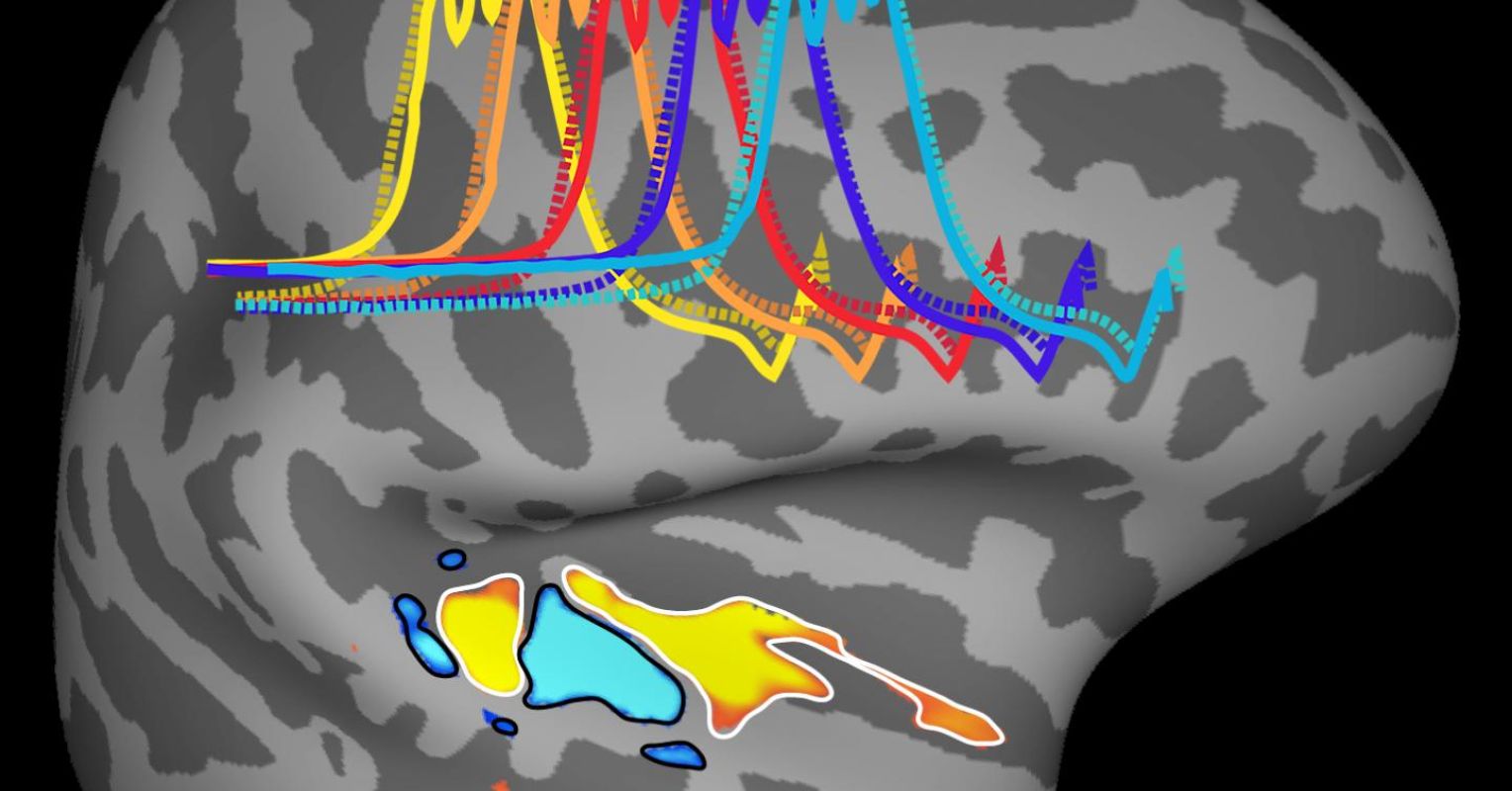 Did Music and Harmonic Sounds Shape the Human Brain? | Psychology Today