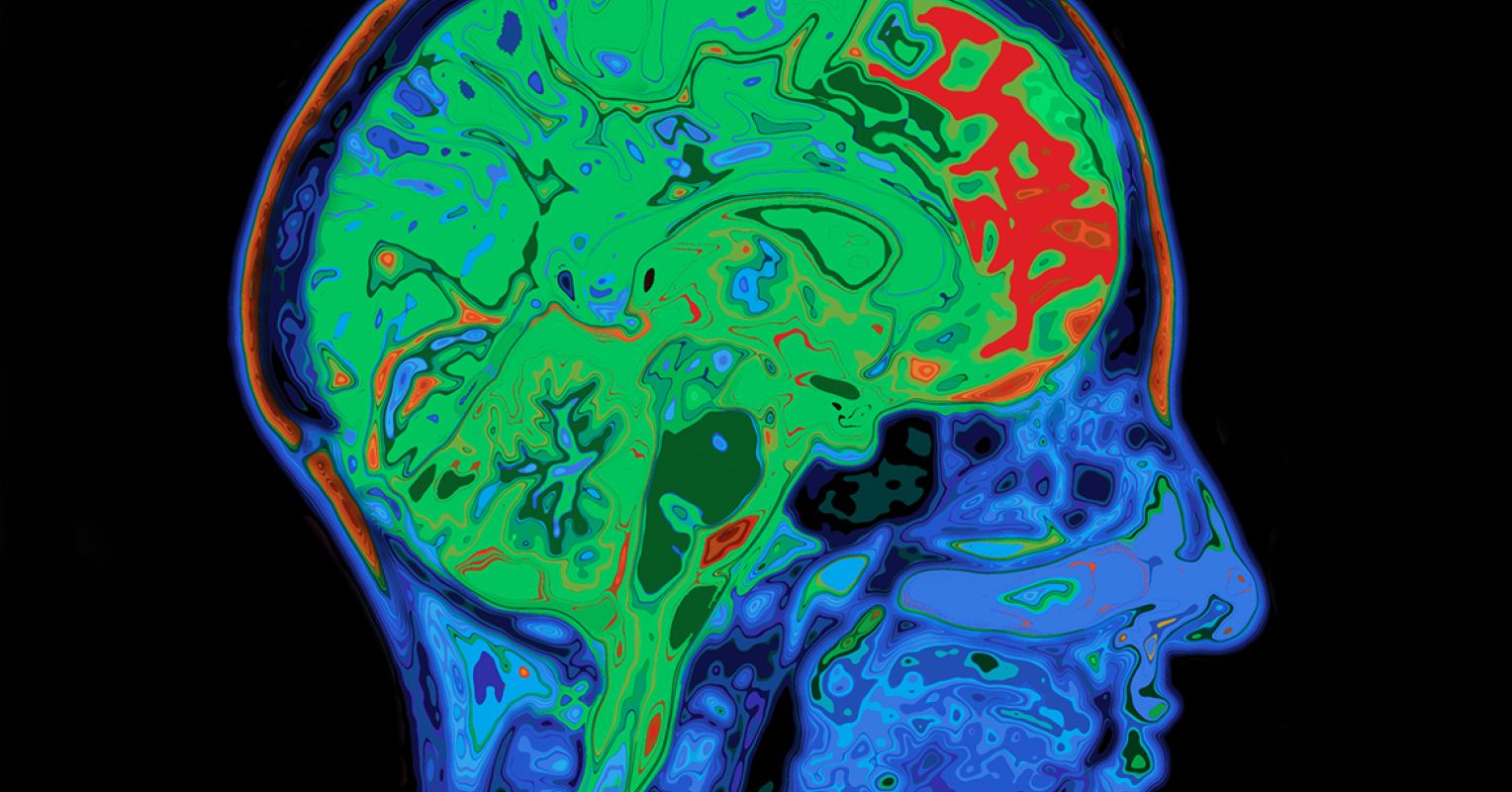 Can Brain Scans Diagnose ADHD? | Psychology Today Australia