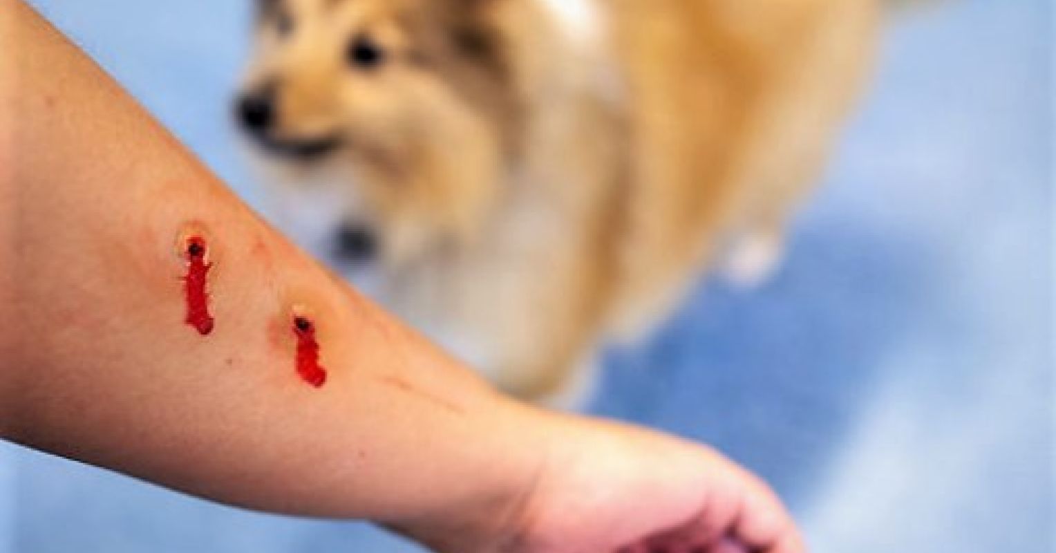 dog bite pictures