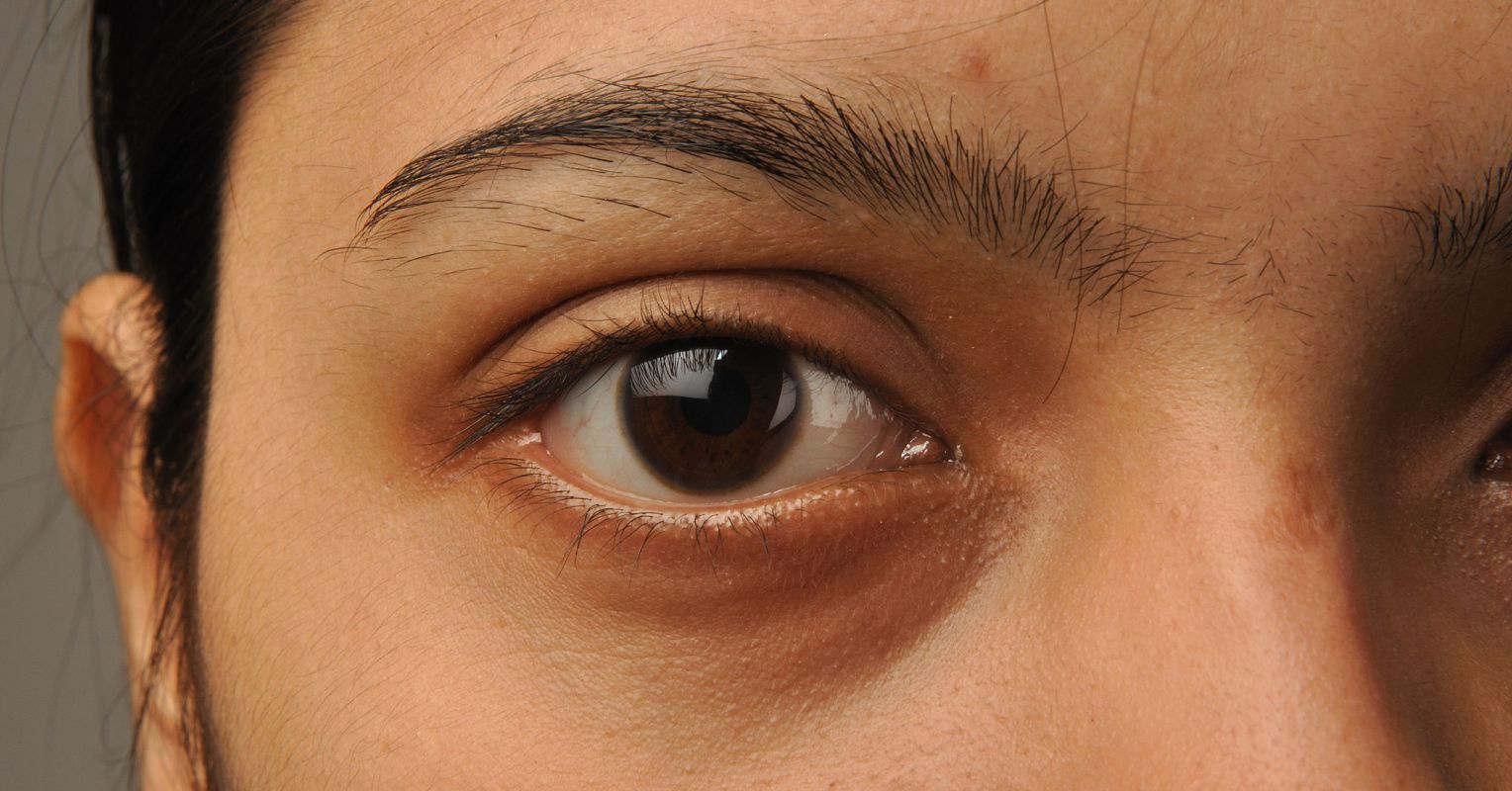 Attraction pupil dilation and Dilated pupils
