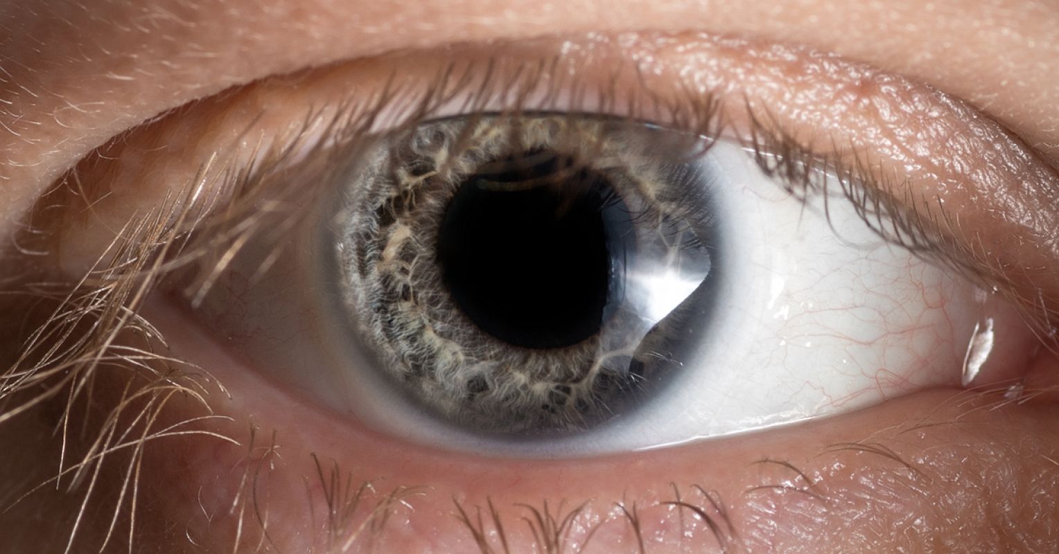 Your Eyes Are a Window Into the Inner Workings of Your Brain