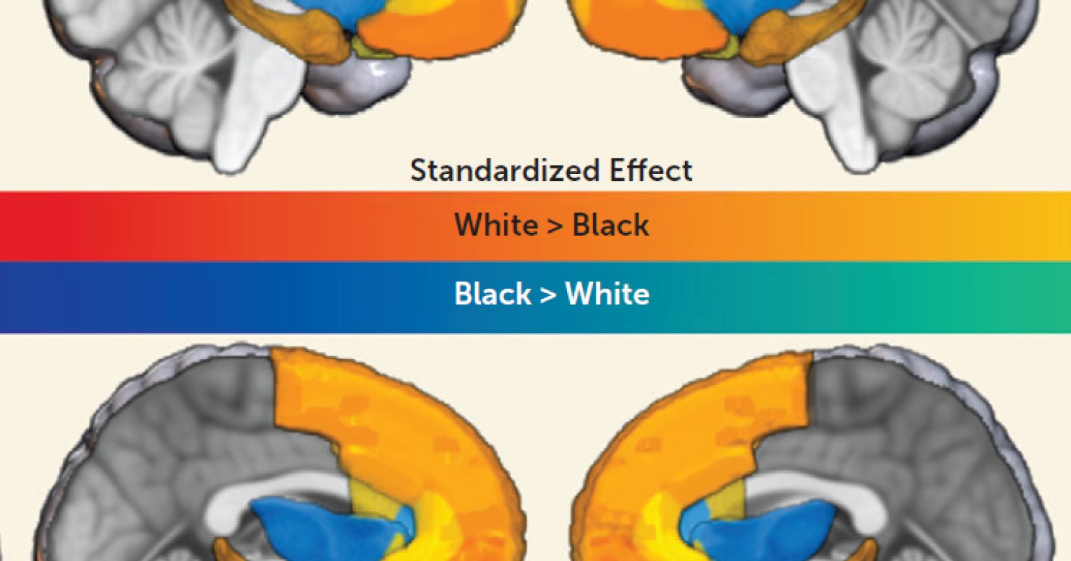The Impact of Racism on the Developing Brain