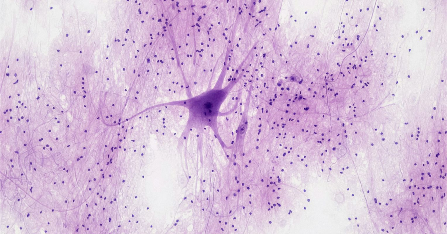 Neuroplasticity for Chronic Fatigue Recovery: Going Deeper