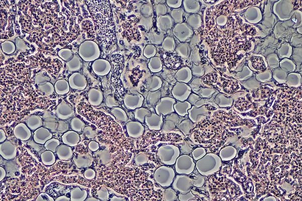 Proliferation of adipocytes in adult parathyroid gland by phase contrast.