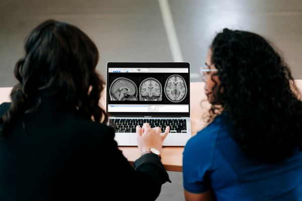 The brain scans showed something nobody was looking for.
