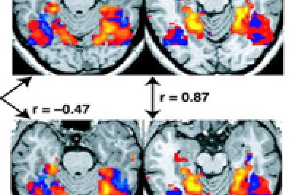 A Map of the Brain That Is Unlike Anything Seen Before | Psychology ...